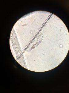 nużeniec pod mikroskopem